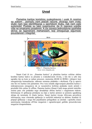 Elementi parcijalnih pločastih zubnih proteza