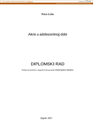 Akne u adolescentnoj dobi