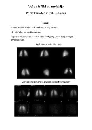 Vežba iz pulmologije