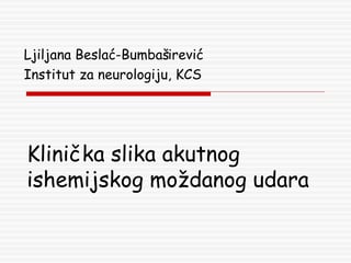 Akutni ishemijski moždani udar