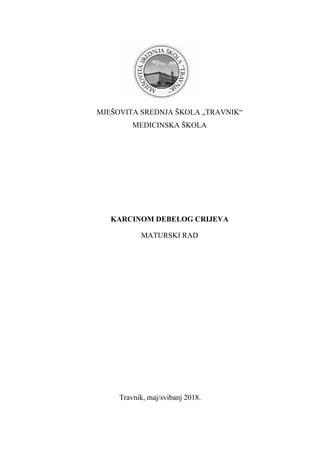 Karcinom debelog creva