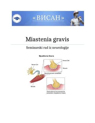 Miastenija gravis