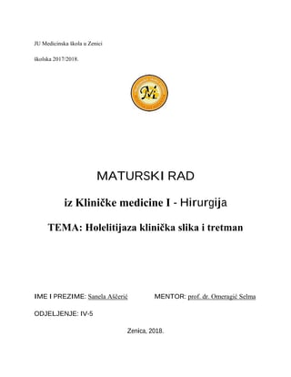 Holelitijaza klinička slika i tretman